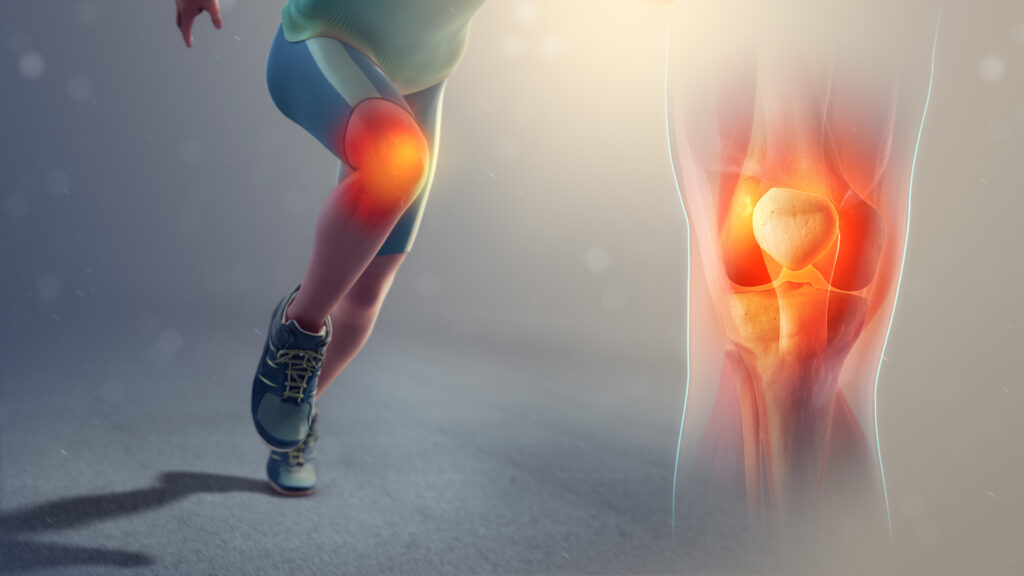 Runners knee orthopedic cure expert doctor Varun Aggarwal in Chandigarh