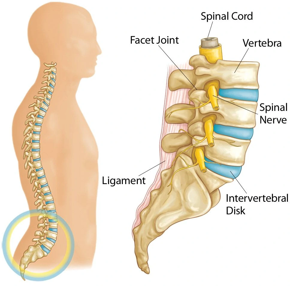 Herniated Disk Symptoms Prevention Treatment Dr Varun Aggarwal