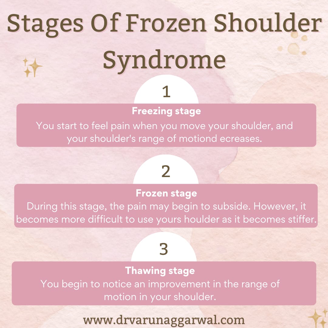 Frozen Shoulder: Easy Ways To Avoid And Treat : Dr. Varun Aggarwal