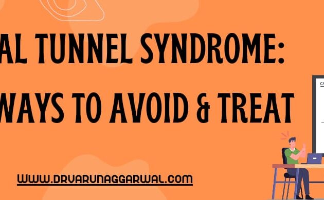 Carpal tunnel syndrome: easy ways to avoid and treat
