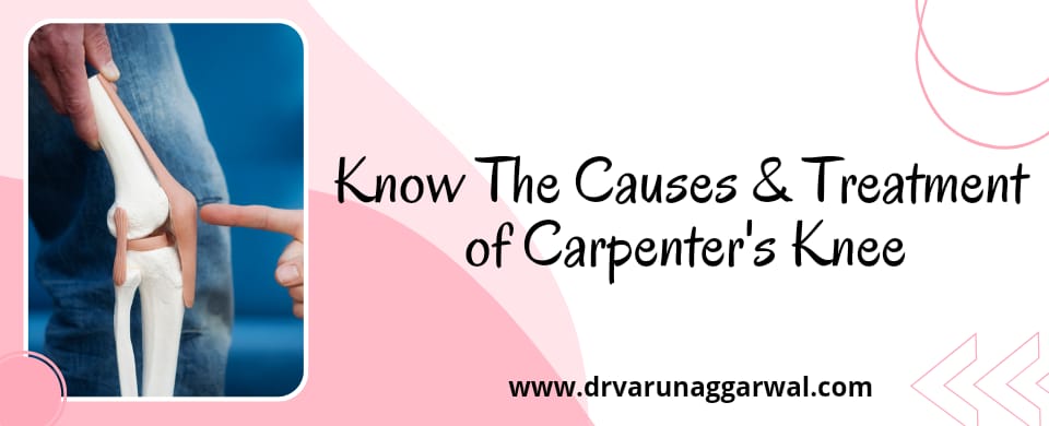 Know The Causes and Treatment of Carpenter's knee