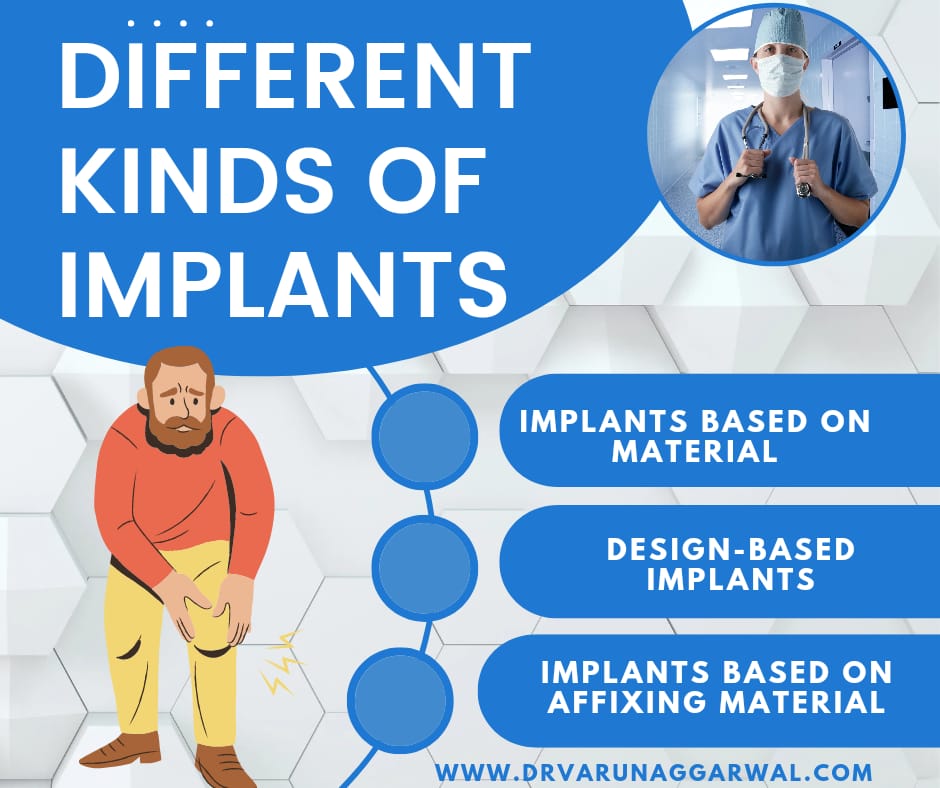 Total Knee Replacement How To Choose The Right Implant