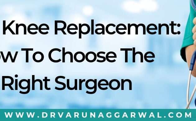 Total knee replacement how to choose the right surgeon