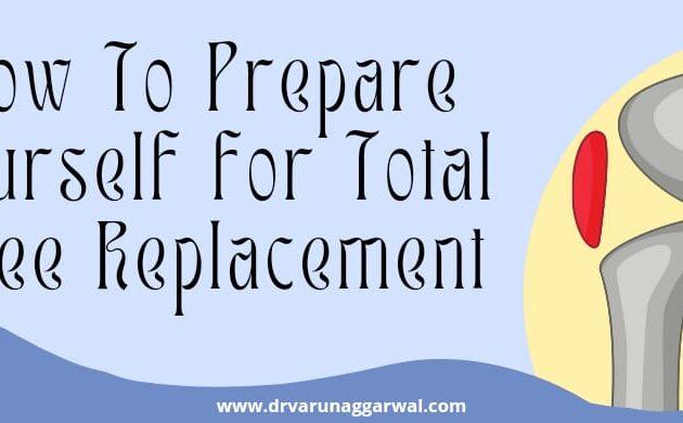 prepare yourself for total knee replacement