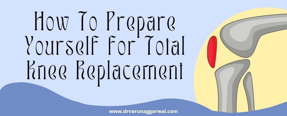 prepare yourself for total knee replacement