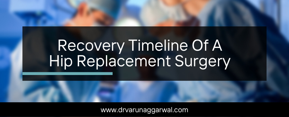 Recovery Timeline Of A Hip Replacement Surgery