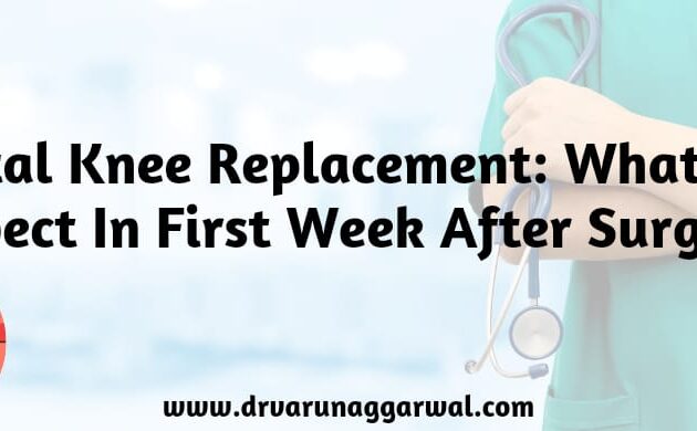 What To Expect In First Week After Knee Replacement Surgery