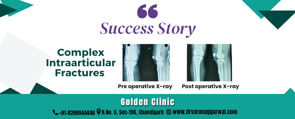 Complex Intraarticular Fractures - A Surgical Success Story