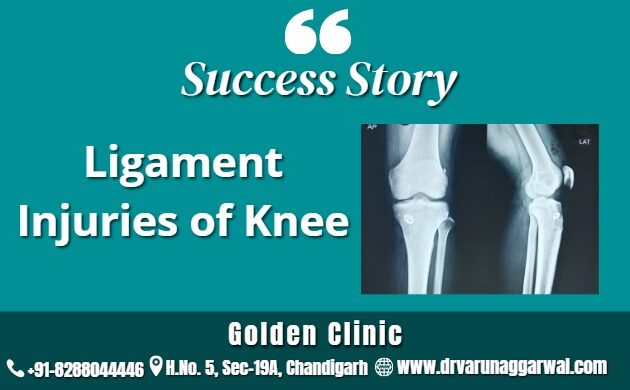 Ligament Injuries of knee