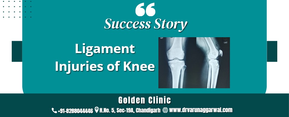 Ligament Injuries of knee